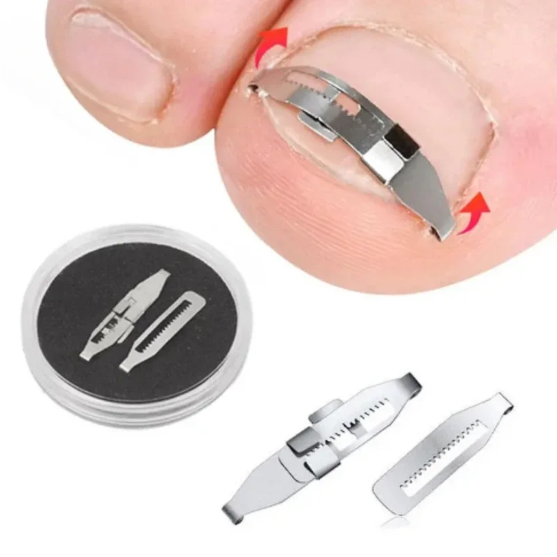 Toe Corrector Ingrown Toenail Corrector Tools Pedicure Recover Embed ToeFoot Care Tool Nail Treatment Professional Ingrown Toenail Correction