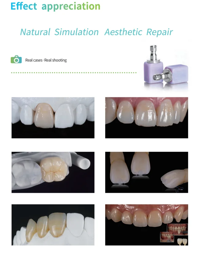 NDI 5 шт. Литий дисиликат C14 керамические блоки для CAD CAM Sirona ...