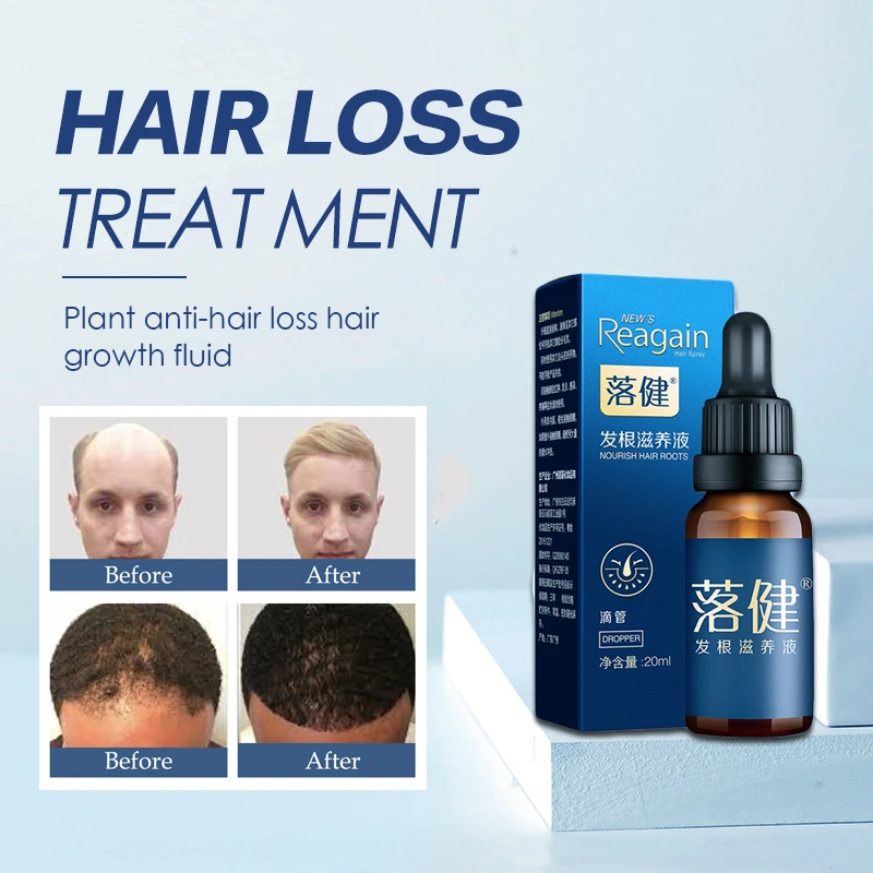 Hair Repro Nourish Hair Roots Anit Hair Loss Product For Men/women Hair And  Beard Care Oil Treatments To Regain Thick Hair - Hair Loss Product Series -  AliExpress