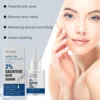 Salicylic Acid Serum Anti Acne Reduce Breakouts Fading Blemishes Shrink Pores Smoothing Repairing Pimples Removal Facial Essence 5