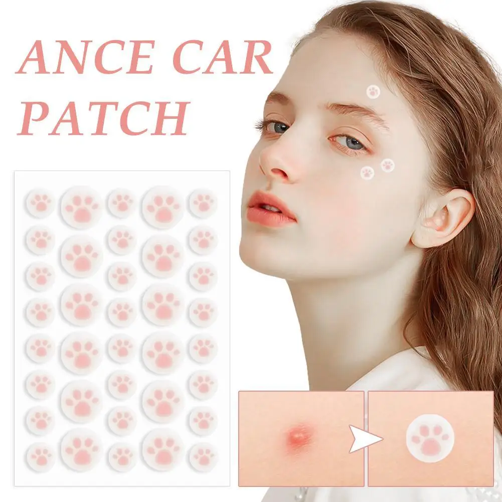 HydrocolloidAcnePimplePatch36CountsCuteCatPawsShapedAcne