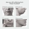 Face Lifting Device Red Light Skin Rejuvenation V Face Massager Double Chin Lift Up with Remote Control Facial Beauty Instrument 6
