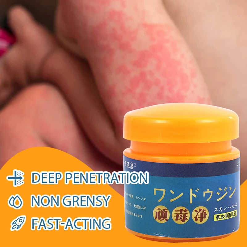 Scorpion Venom Skin Cream Relieve Psoriasis Eczema Allergic Dermatitis Herbal Antibacterial And Antipruritic 20g skin care ointment