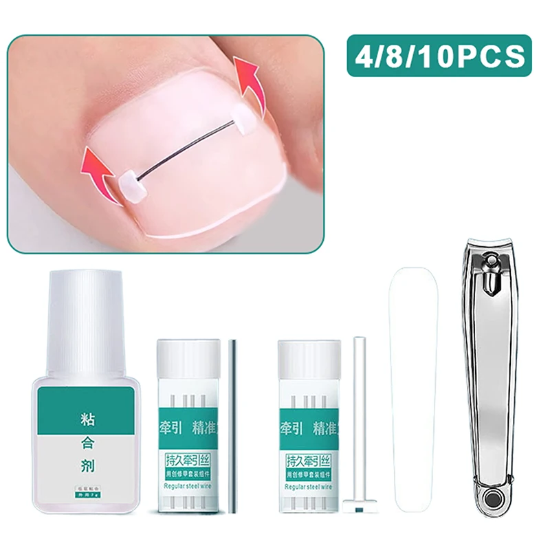 

Ingrown Toenail Corrector Tools Pedicure Recover Embed Toe Nail Treatment Professional Ingrown Toenail Straightening Clip Brace~
