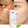 Dark Spot Corrector Skin Whitening Fade Cream Lightening Blemish Removal Serum Reduces Age Spots Freckles Face Cream 20g 1
