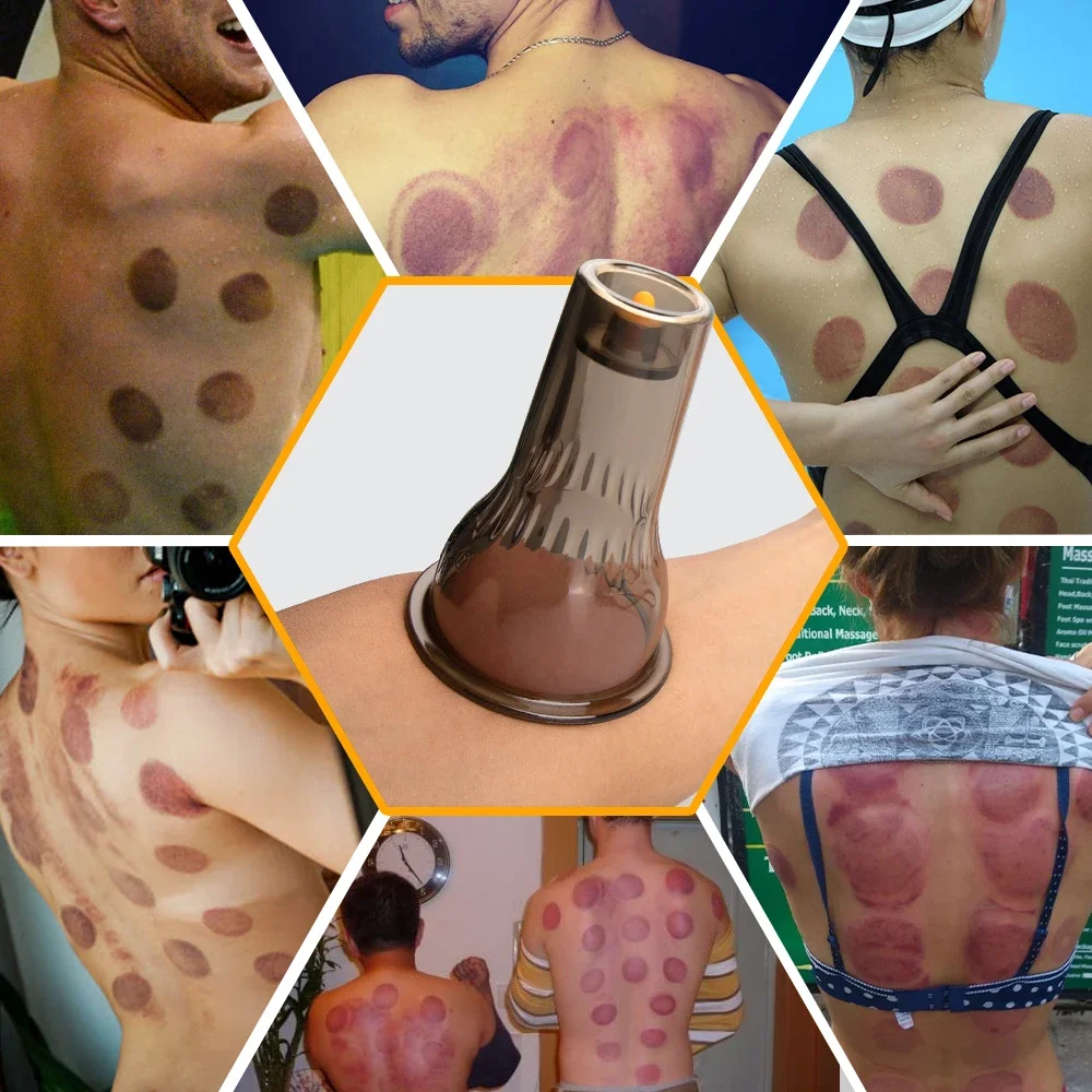 Gua Sha Vacuum Massage Jars Suction Cups Set Vacuum Cupping Glasses Anti Cellulite Fat Burner Cupping Therapy Ventosas Slimming 4