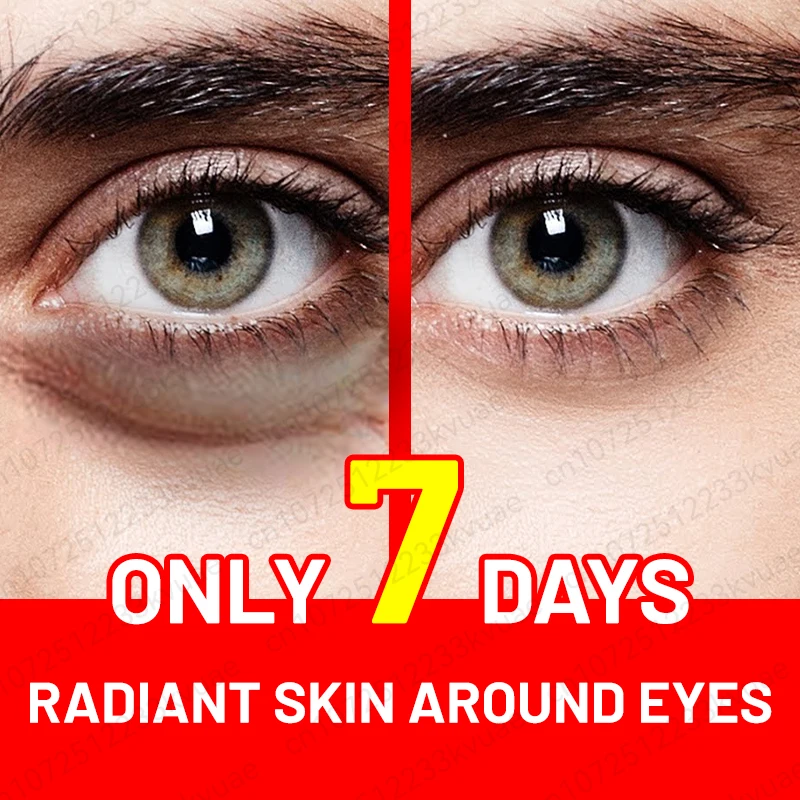 EyeCareAntiWrinkleEyeCreamDarkCirclesRemoveEyeBagsPuffyEyes