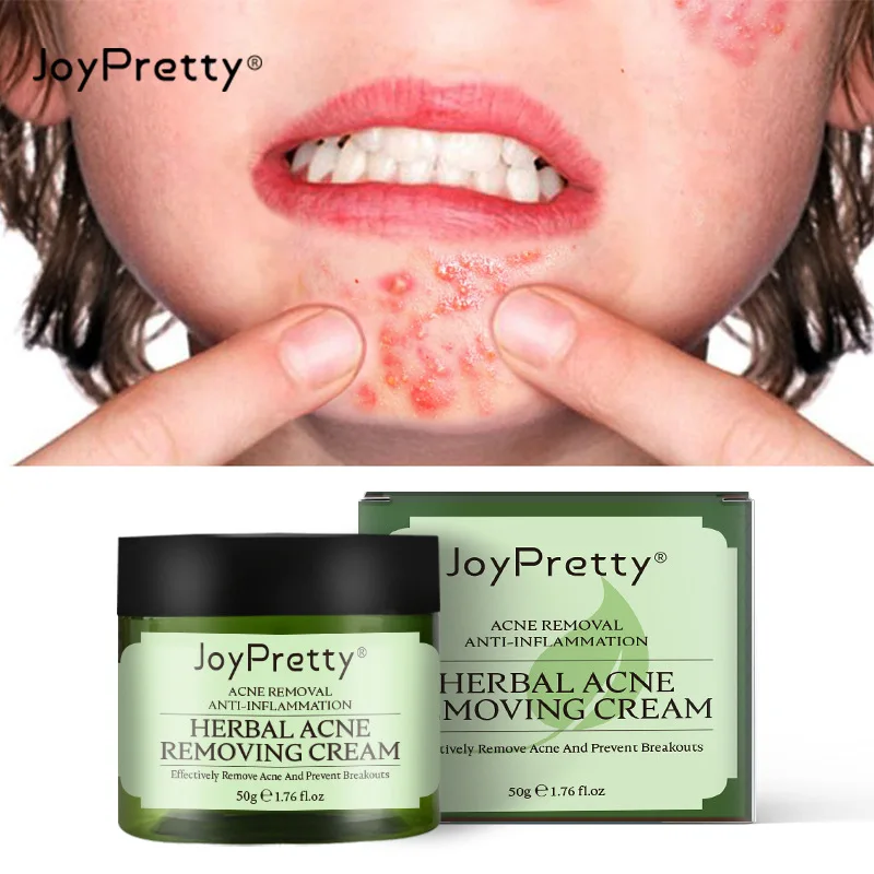 JoyPretty Herbal Acne Removal Face Cream Against Pimple Remover Ance Treatment Anti Ance Moisturizing Repair Damage Skin Care