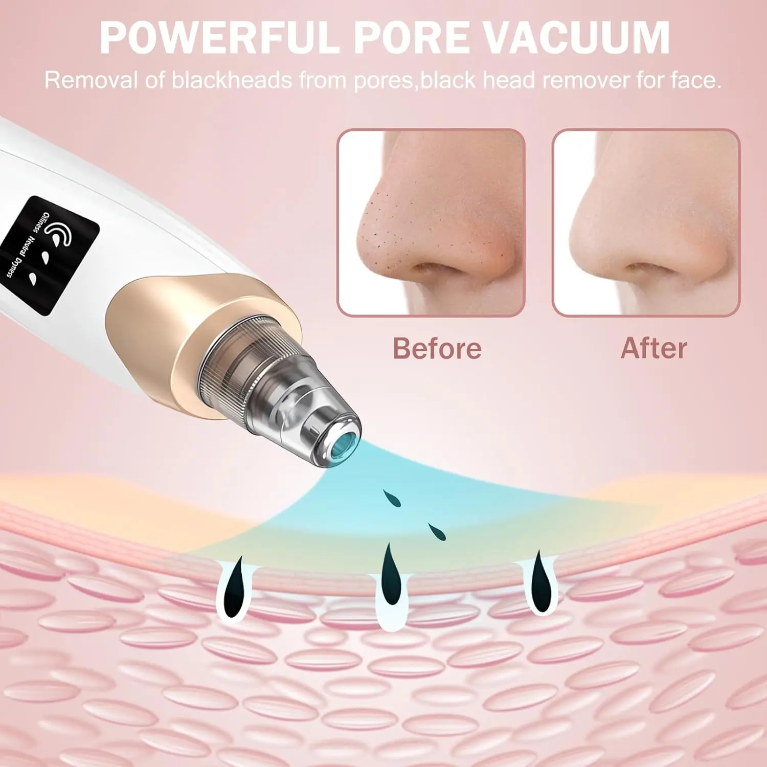 Electric Blackhead Remover Pore Vacuum Kit Blackhead Extractor Tool with 3 Suction Level 5 Probes Suitable for Women and Men