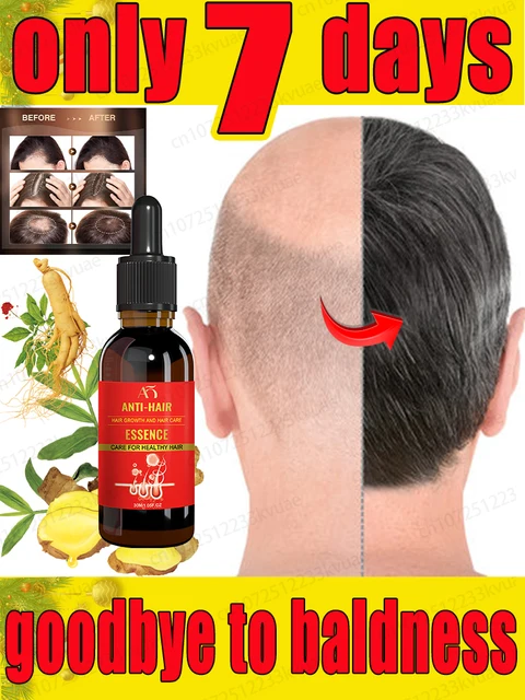 Essential Oil Accelerate Hair Growth - Free Shipping - 01