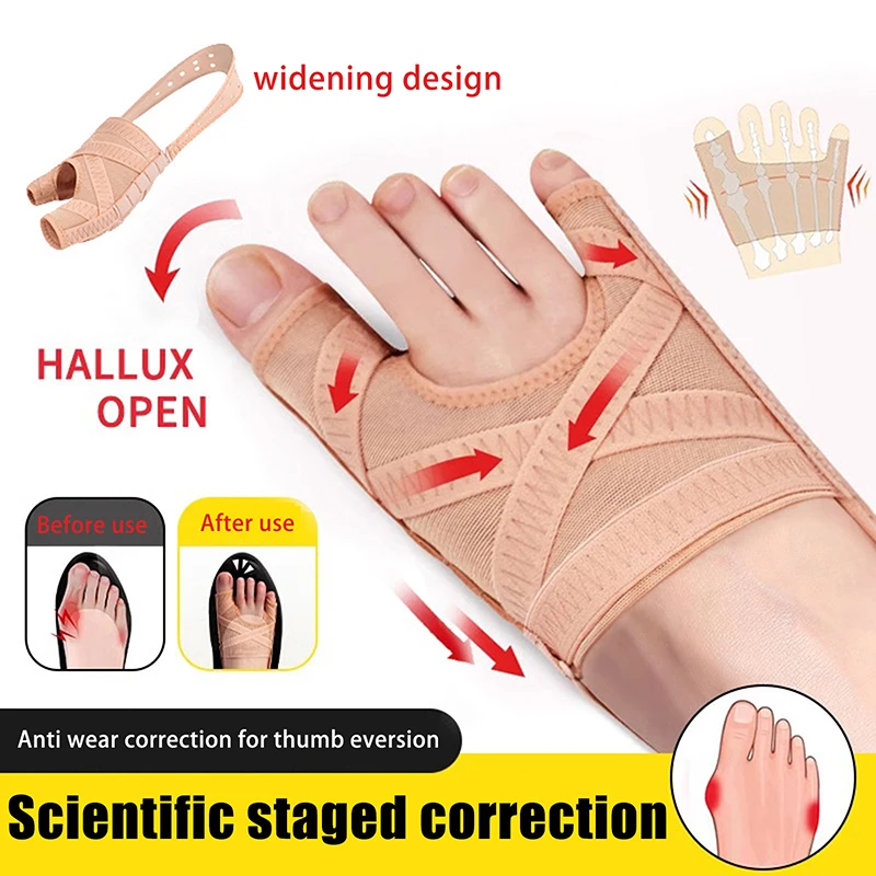 New Fabric Bunion Corrector Toe Separator Adjustable Hallux Valgus Sleeve_voghion.com