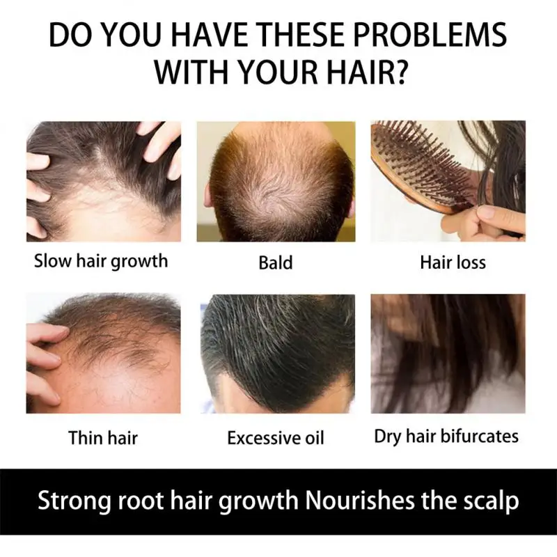 Рисунок 2 - Микроролик для волос способствует