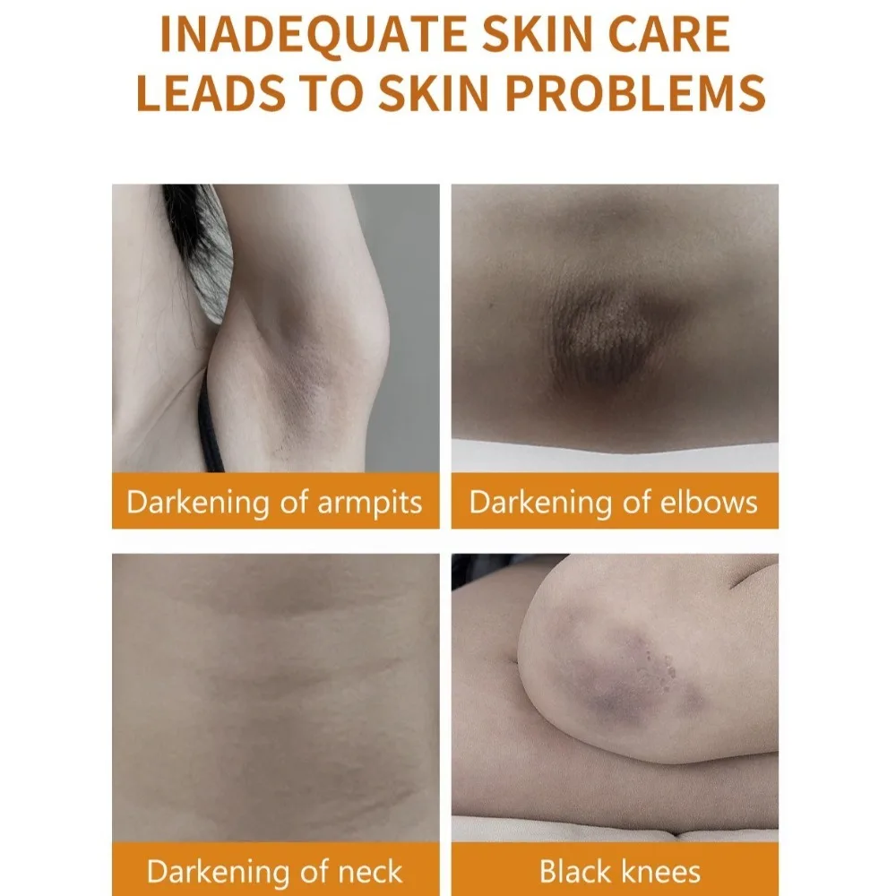 New Even Skin Tone Armpit Cream Lighten Melanin Pink Deep Moisturizing Whitening Cream Instant Result Moisturizing