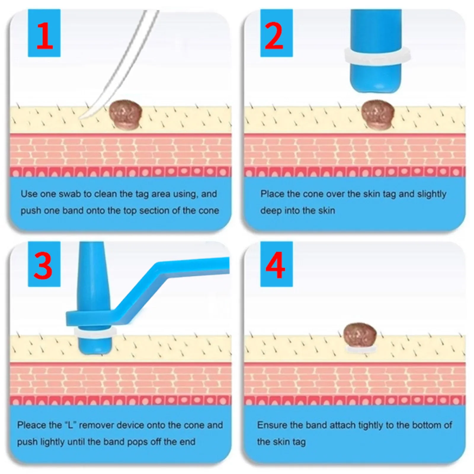 1-5mm/4-9mm Remove Skin Tag Shrink Rubber Ring 30pcs/box Non Toxic Health Beauty Skin Care Tools Tag Removal Mole Wart Removal