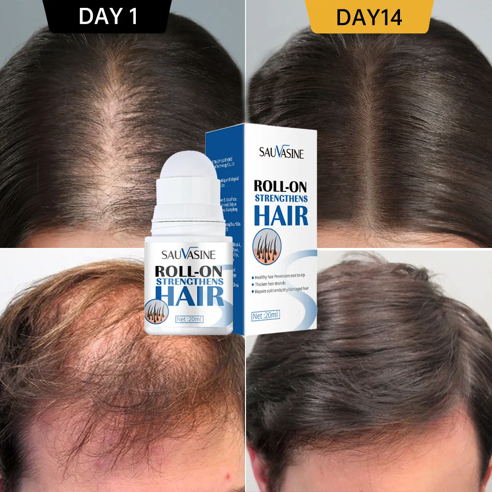 

Fast Hair Growth Roller Serum Anti Hair Loss Serum Baldness Repair Hair Loss Scalp Treatment Grow Thicker/Longer Hair Serum