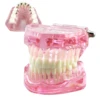 Dental Orthodontic Typodont Teeth Model With Self-Ligating Metal Ceramic Bracket Lingual Hawley Retainer Ligature Standard Demo 3
