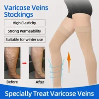 1 Pair Thigh High Compression Stocking for Women and Men, 20-30mmHg Toeless Compression Socks for Varicose Veins, Edema, Flight 2