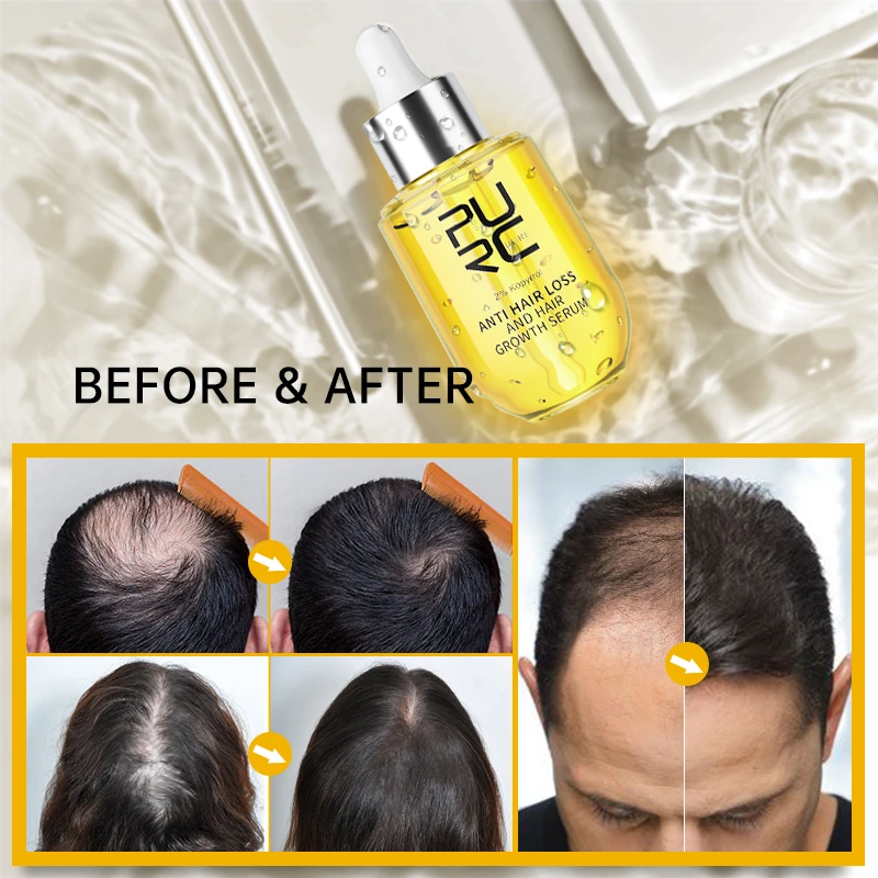

Hair Growth Oil Fast Hair Growth Effective Baldness Repair Hereditary Hair Loss Postpartum Hair Loss Seborrheic Hair Loss