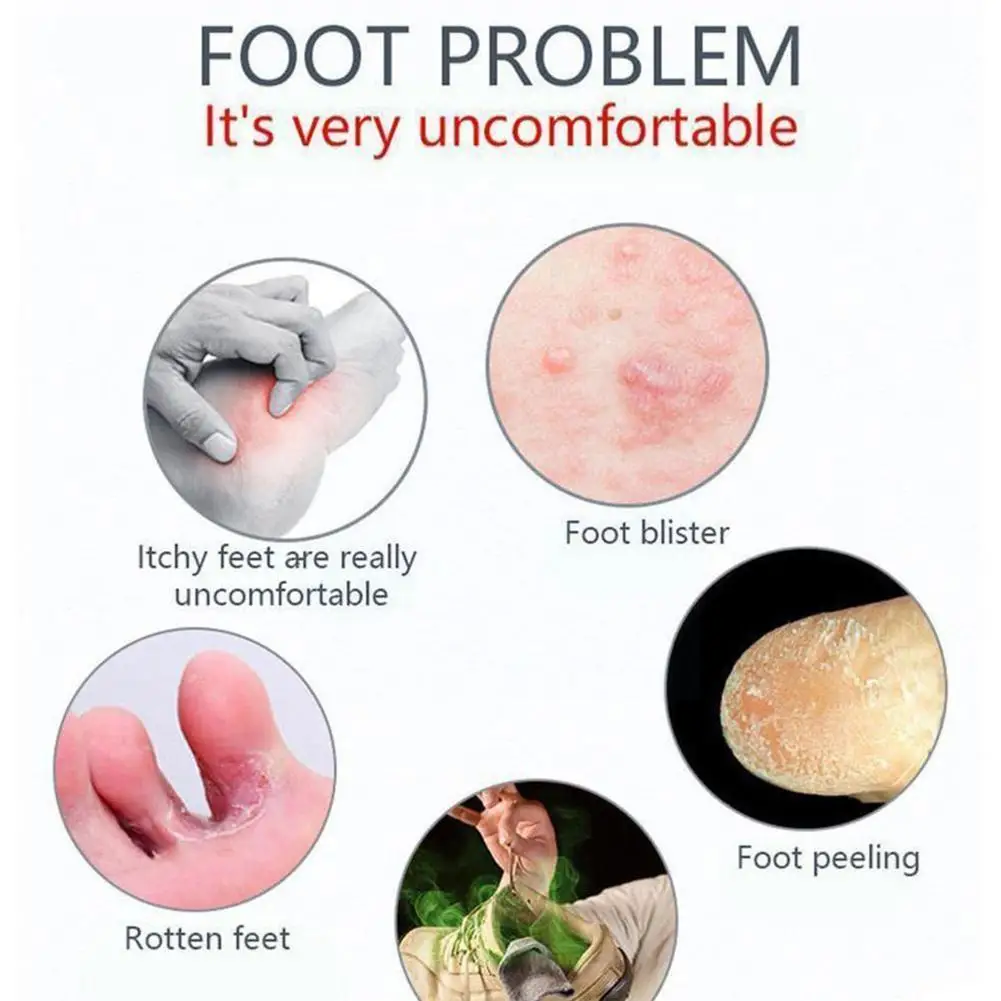 40g Herbal Anti-fungal Foot Powder Antibacterial Deodorant Itch Foot Antifungal Powder New Sweat Odor Anti Care herbal foot cream