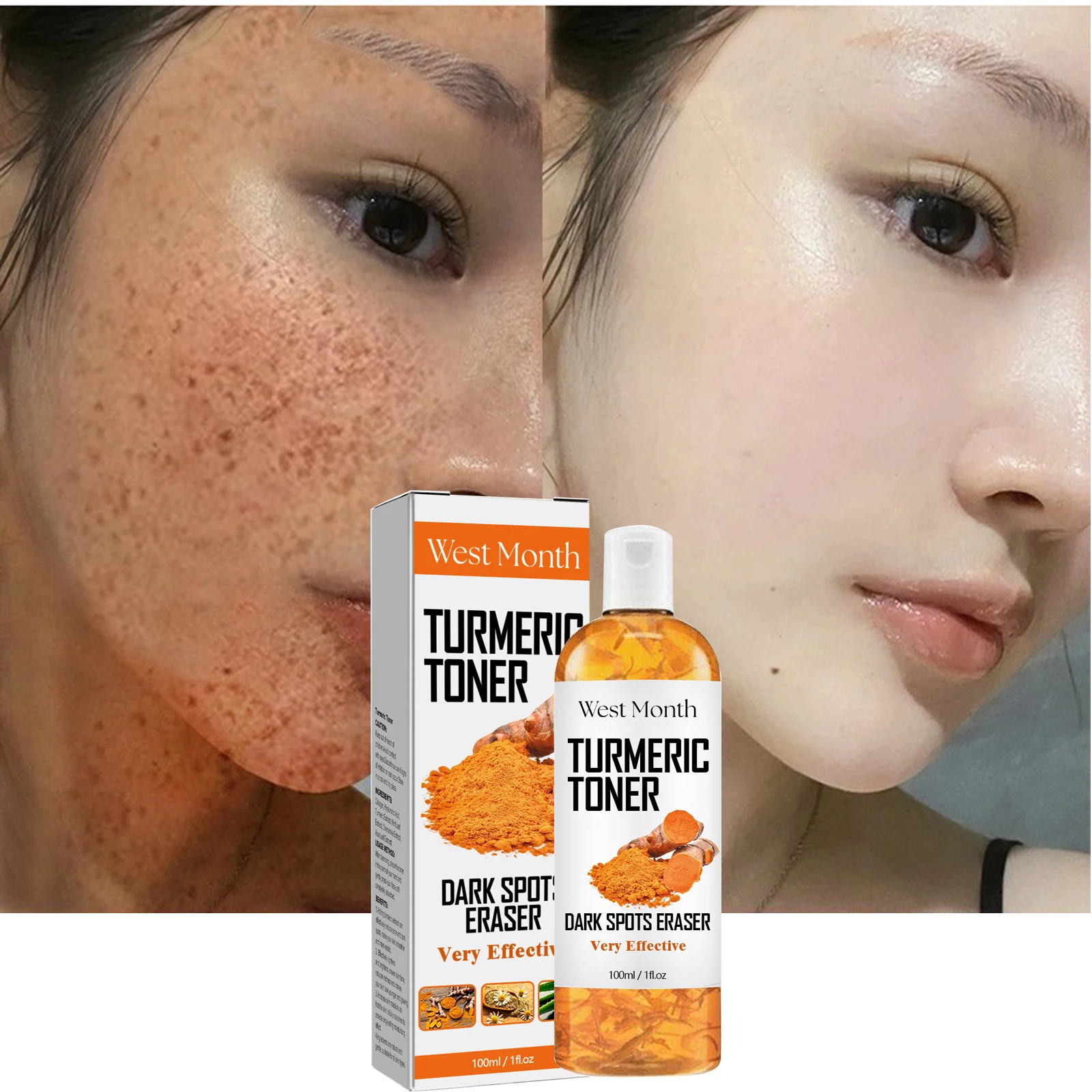 Tumeric Dark Spots Whitening Freckles Essence Turmeric Remover Fade Dark Acne Brightening Melasma Pigmentation Moisturizing Skin
