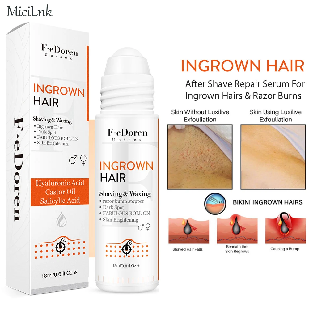 

Razor Bumps Removal Solution Ingrowns Hair treatment After Shave Repair Dark Spot Reduce Redness Serum for vanish PFB Skin Care