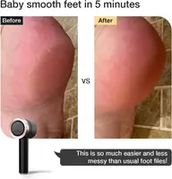 Electric Foot File Callus Remover, Rechargeable with Built-in Vacuum – Mess-Free, Painless, Powerful Pedicure Tool Kit for Smoot 2