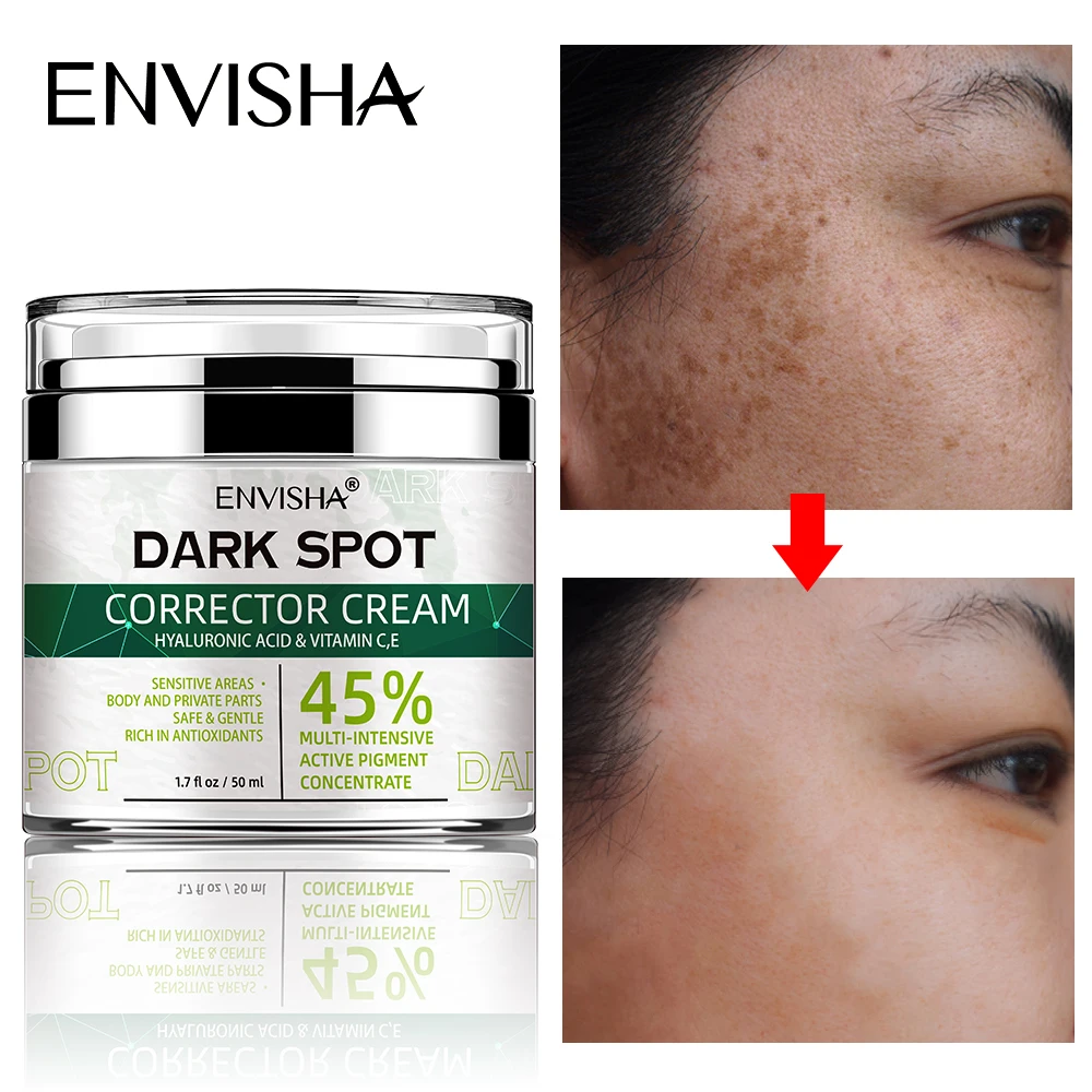 ENVISHA Face Skin Care Whitening Freckle Cream Remove Melasma Dark Spots Melanin Brighten Anti-Aging Lightening Shrink Pores