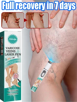 Varicosse Cream Laser