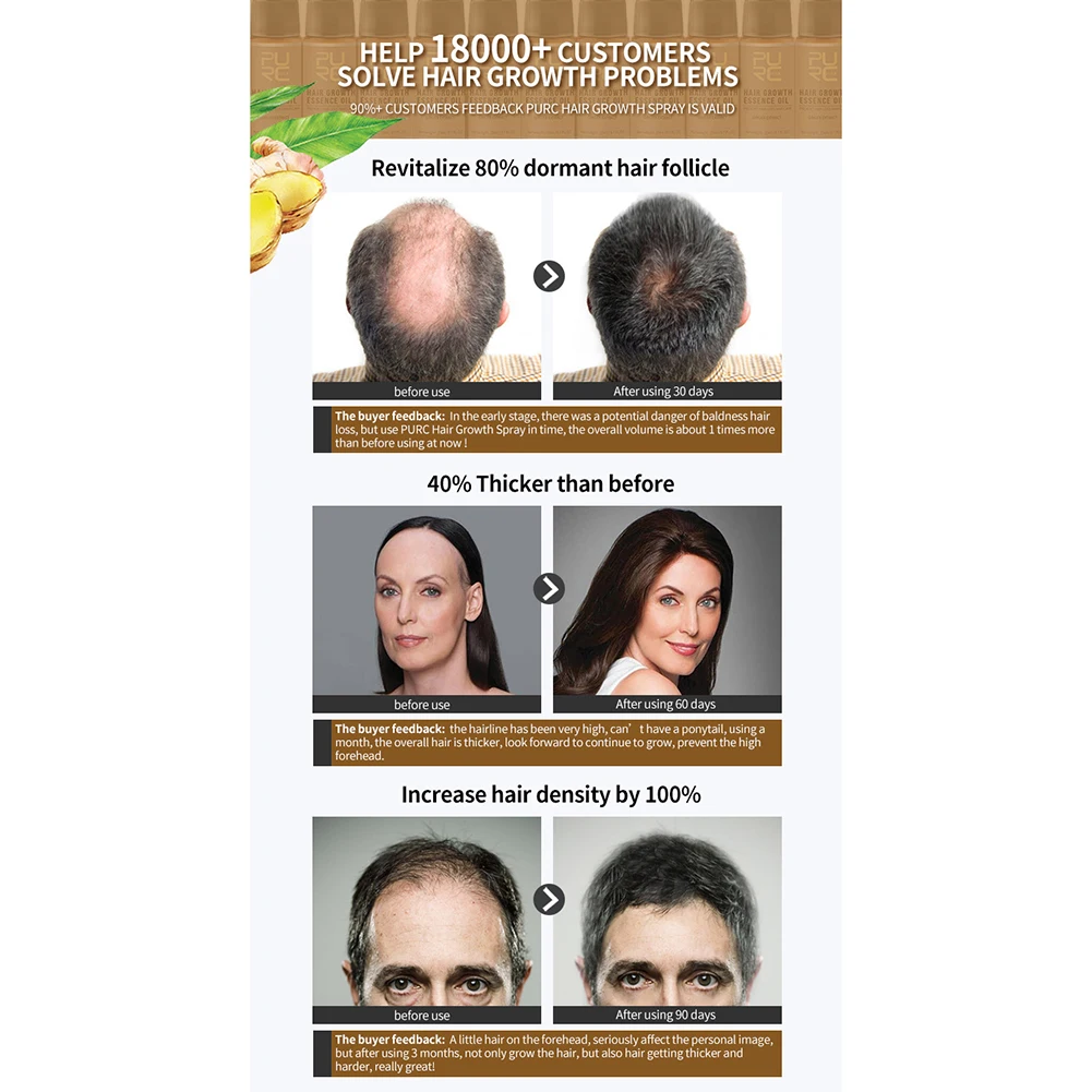 Ginger Hair Growth Essential Oil Hair Treatment Anti Lost Beauty Product hair growth oil hair restoration products