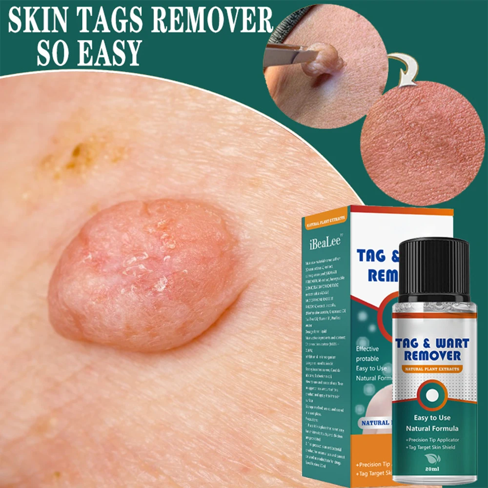 

Skin Tag Remover Blemish Removers Painless Mole Skin Dark Spot Wart Removal Serum Freckle Face Tags Treatment Remove Cream