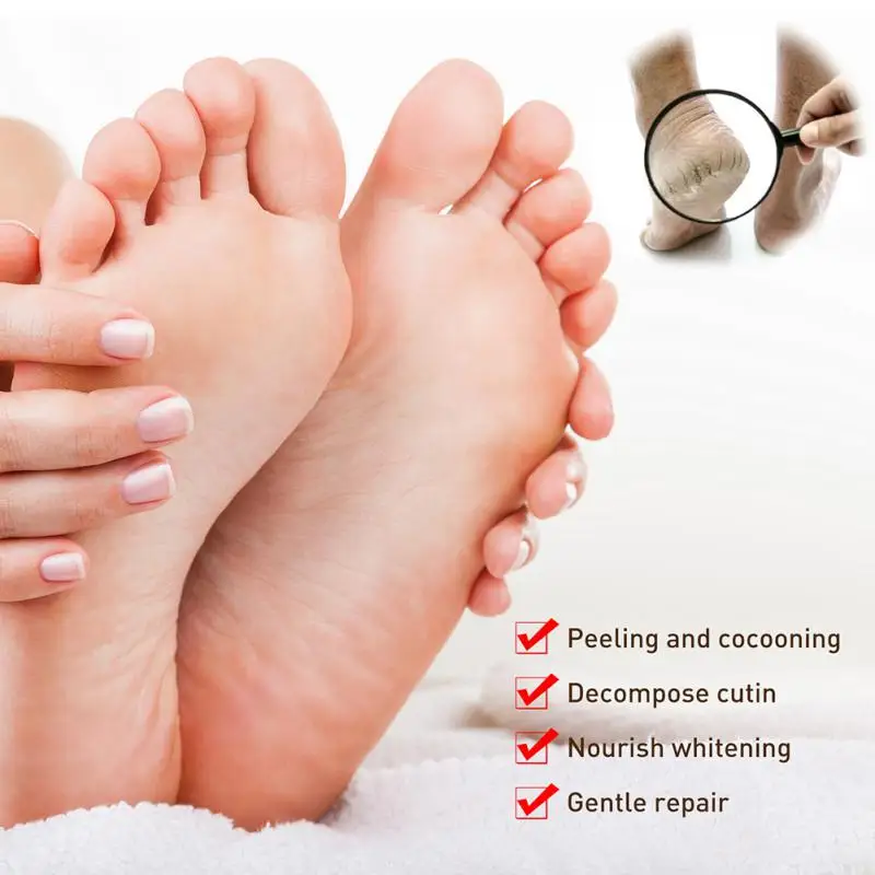 https://ae01.alicdn.com/kf/S9b3ecfd3a84d437682ba5bb5a05345ff2/Natural-Foot-Cream-Anti-Dryness-Heel-Cracked-Repair-Cream-Removal-Callus-Dead-Skin-Soothes-Mositurizing-Brighten.jpg