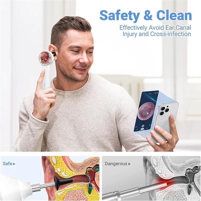SUNRI-Digital Otoscope With Light, 1.85 In IPS Screen, 720P HD Video Ear Camera, Ear Wax Removal Tool 3