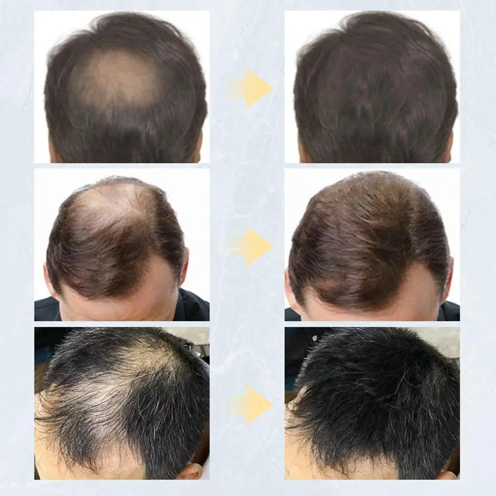 Description Picture 3 of itemHair Fluffy Powder Increases Hair Volume Mattifying Powder Finalize Hair Design Styling Hair Therapy Powder Hair For Men Women