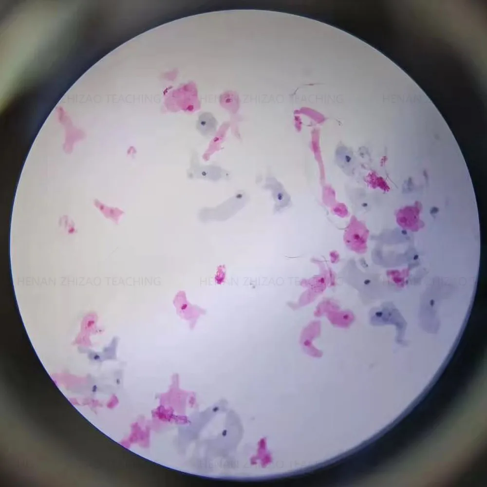 Amoeba Microscope 400x: What You Need to Know Before Buying Prepared Slides  for Classroom Use, image size:1000x1000
