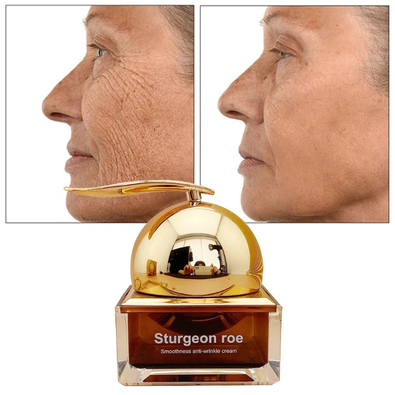 50g Sturgeon Roe Anti-Aging Face Cream Moisture Oil Control Whitening Repair Compact Fade Fine Lines Nourish Skin Facial Care