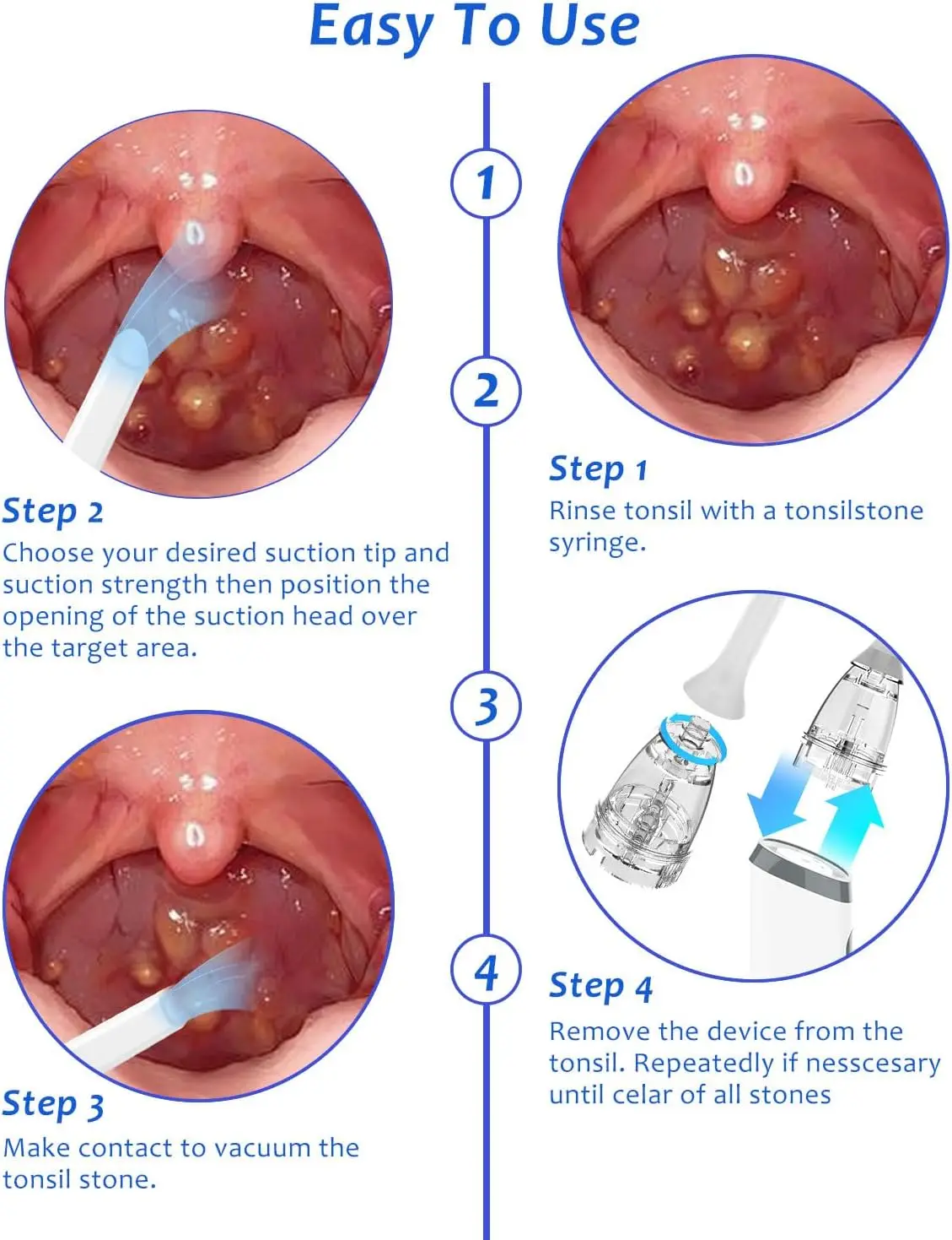 Electronic Vacuum Tonsil Stone Remover Kit With LED Light 8 Suction Modes Anti Bad Breath Oral Fresh Care&Tongue Coating_voghion.com