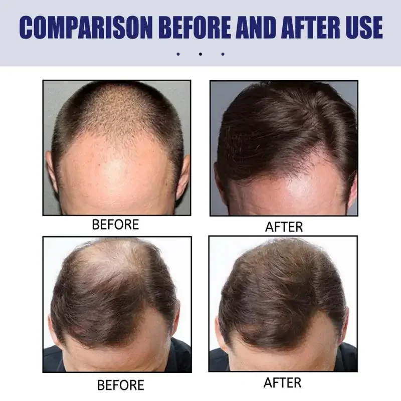 Hair Fibers Keratin Topic Thickening Spray Hair Building Fibers 27.5g Loss Products Instant Regrowth Powders Growth Product hair building powder hair building fibers hair growth spray