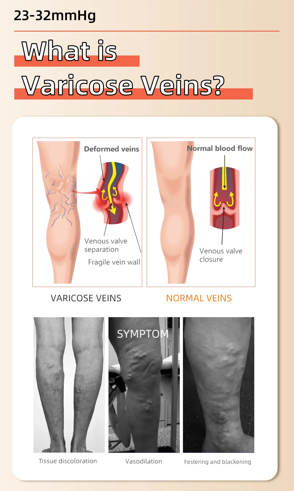 Legbeauty 23–32 mmHg elastische medizinische Kompressionssocke für Damen, Krampfadern-Ermüdungslinderung, Beinwärmer, Druck-Waden-Ärmelstrumpf – Detail 8