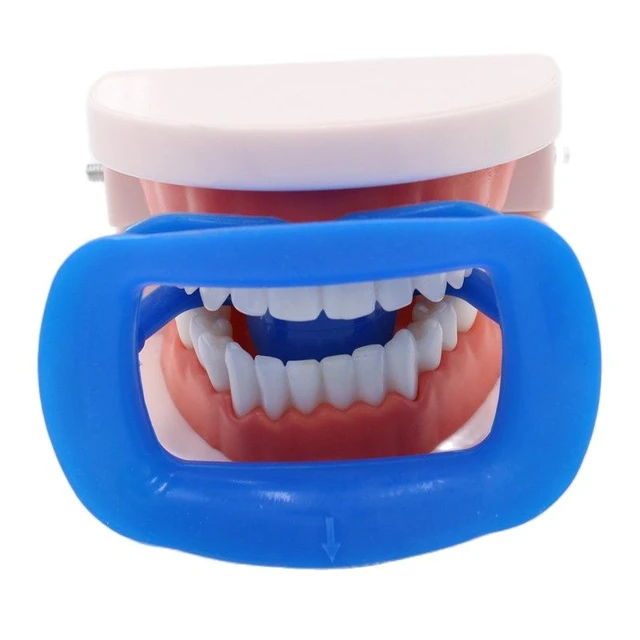 Nuovo 1pc divaricatore dentale morbido silicone intraorale labbro guancia divaricatore  bocca apri guancia espandere ortodontico dentale - AliExpress
