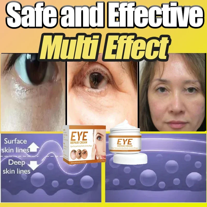 Eye Bags Remover Eye Cream Eye Problem Solver Instant Remove Wrinkle Eye Cream Eye Bags Dark Circles Anti Puffiness Firm Cream Under Eyes Lightening Fine Lines Moisturizing
