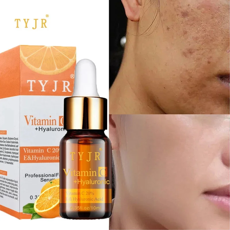 Freckle Remove Serum Vitamin C Brighten Whitening Face Essence Fade