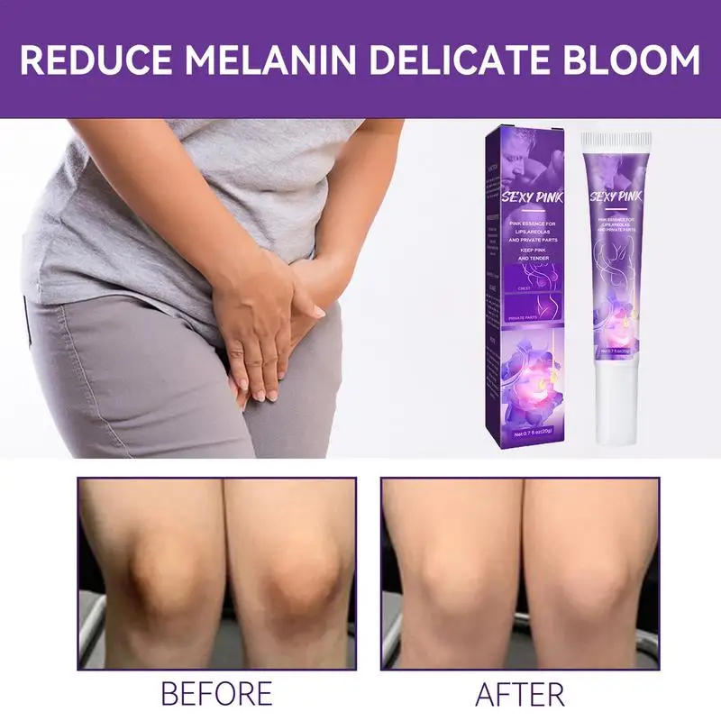Body Whitening Cream Private Parts Underarm Bleaching Serum Whiten Butt Knee Brighten Inner Thigh Intimate Parts Dark Remove 5