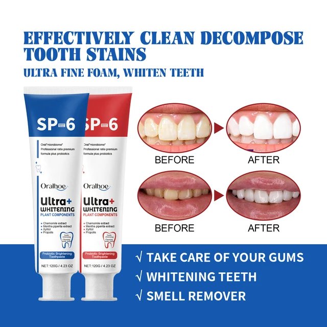 Sp-6 Probiotics Brightening Toothpaste Cleansing Tartar Remove Dental Plaque Fresh Breath Prevent Periodontitis Oral Teeth Care 6