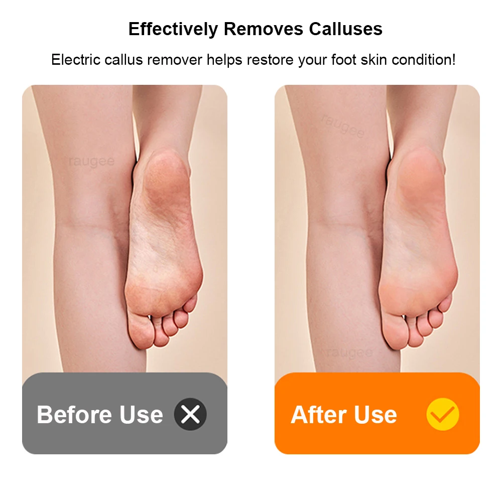 Râpe pieds électrique rechargeable usb anti-callosités pieds_voghion.com