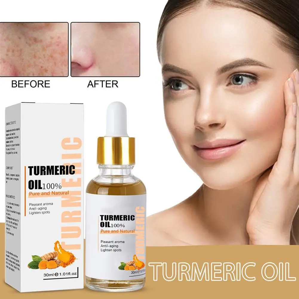 

Turmeric Melasma Whitening Correcting Serum Facial Essence Oil Dark Spot Removal Fade Pigment Freckle Skincare