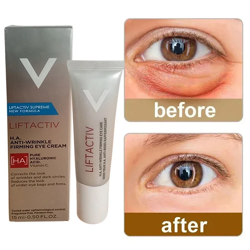 

Peptide Collagen Eye Cream Anti-wrinkle Anti-dark Circles Fade Fine Lines Remove Fat Particles Eye Skin Care Beauty Products