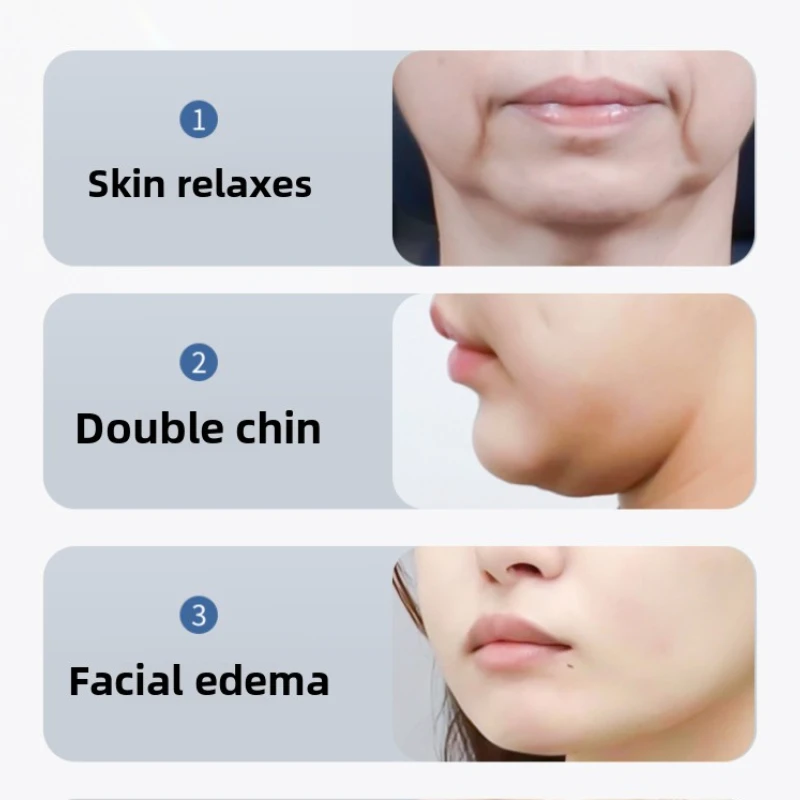 Face Rolling Massager EMS Face Slimming V Line Facial Lift Phototherapy Massager Wrinkle Remover Body Skin Tightening