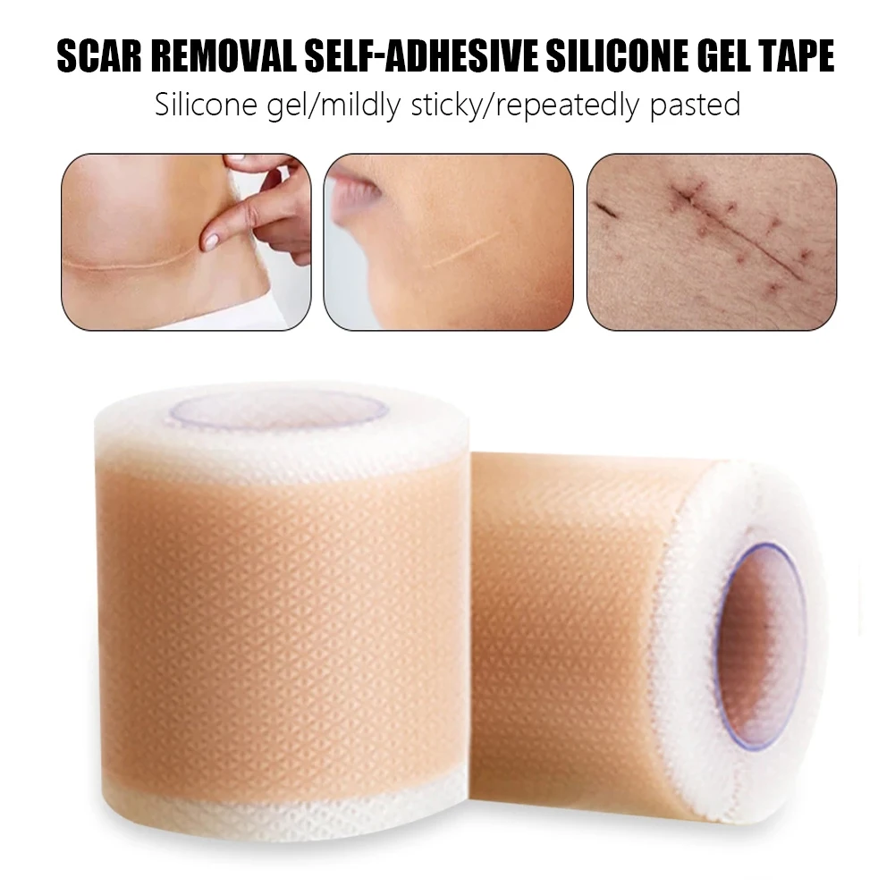 10 150CM Efficient Beauty Self Adhesive Silicone Gel Tape Removal Scar