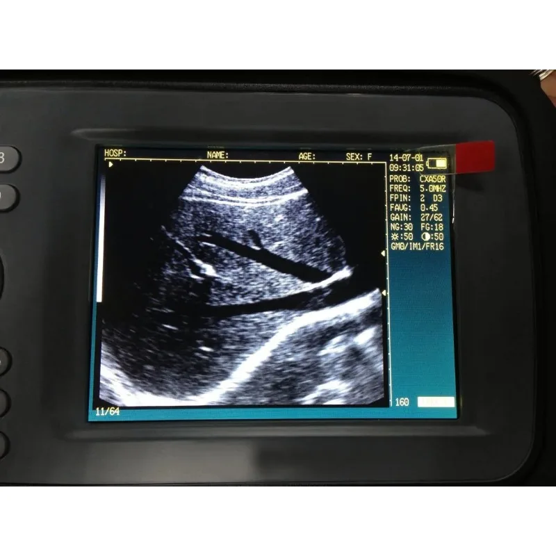 DM Cheap Clinic Handheld  Machine Portable Vet Ultrasound for Animal Machine