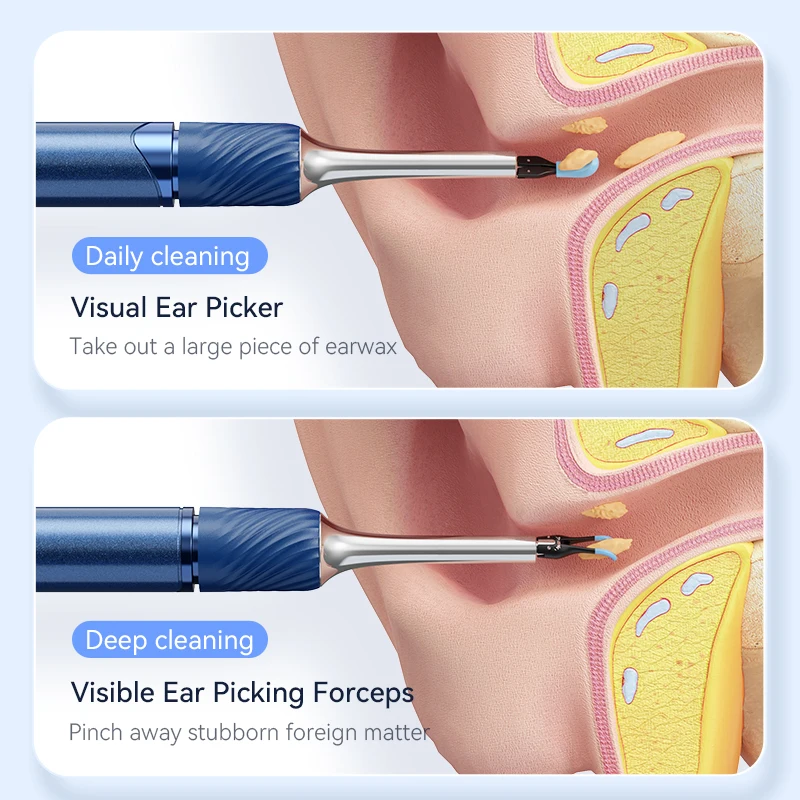 Smart Visual Ear Spoons Endoscope Tweezers  Cleaner with Camera Otoscope Health Care Ear Cleaner 12 Megapixels Earwax Removal 4